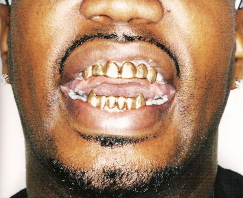dientes-oro